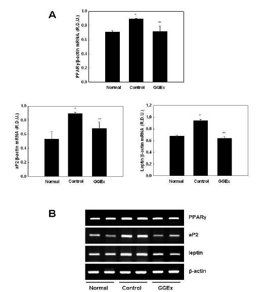 The mRNA expression levels of of adipocyte marker genes in visceral WAT.