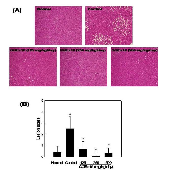 Effects of GGEx18 on hepatic lipid accumulation in high-fat diet-induced obese mice.
