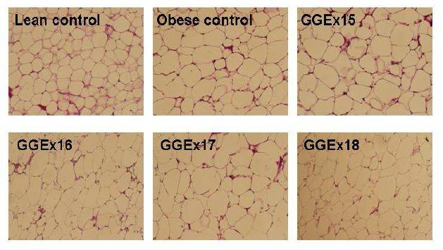 Light microscopy of epididymal white adipose tissues stained with hematoxylin and eosin