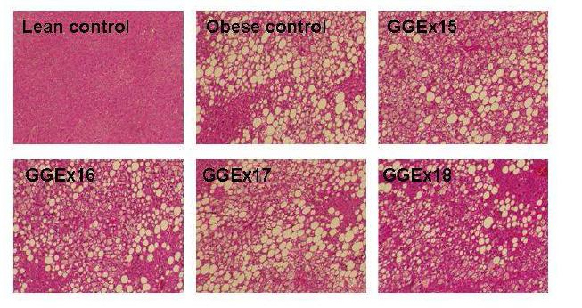 Inhibition of hepatic lipid accumulation by GGEx in genetically obese ob/ob mice.