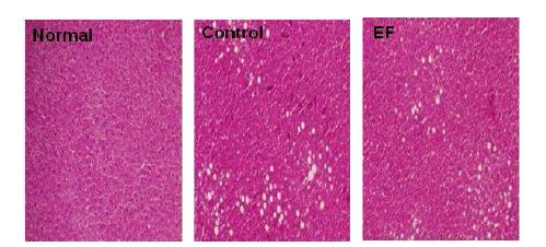 Inhibition of hepatic lipid accumulation by GGEx18 fraction EF in high fat diet-fed obese mice.