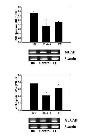 Effects of EF on mRNA expression of genes involved in mitochondrial fatty acid β-oxidation in differentiated 3T3-L1 cells.