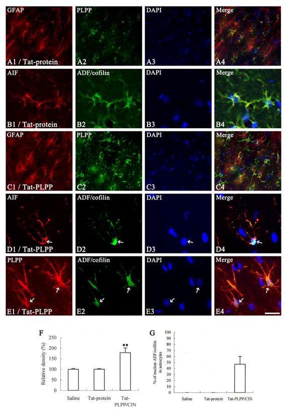 The effect of transduction of Tat-PLPP/CIN on nuclear translocation of ADF/cofilin in astrocytes