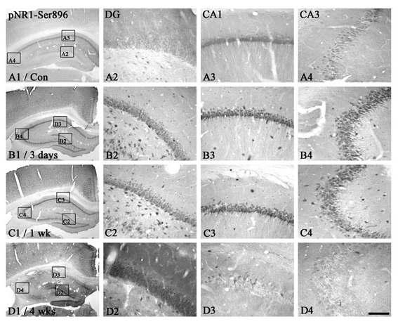 pNR1-Ser896 immunoreactivity in the rat hippocampus