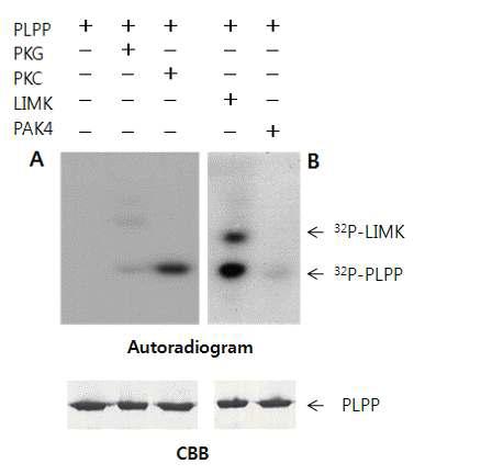 Phosphorylation of PLPP in vitro