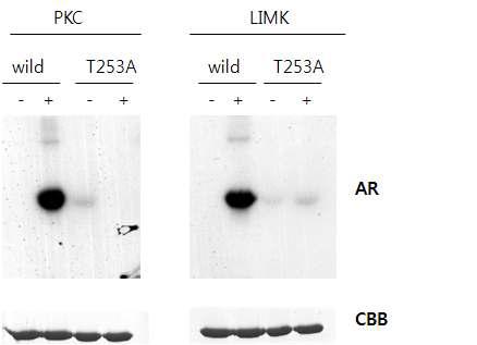 Absence or presence of PKC or LIMK were incubated with wild-type or threonine-to-alanine mutated purified His-PLPP in vitro assay