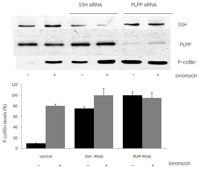 PLPP participates in ionomycinn induced cofilin phosphorylation