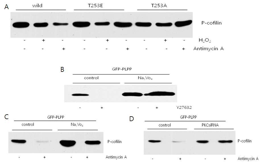 PLPP mediates Phospho cofilin turnover during ATP depletion