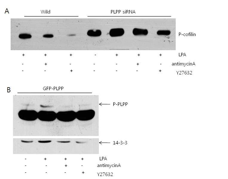 RhoA promotes PLPP phosphorylation