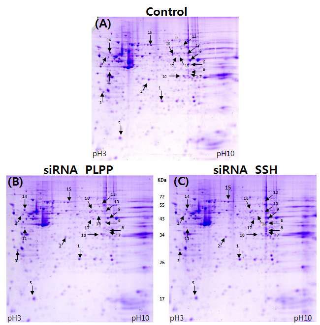 Coomassie-stained 2-DE gel pattern of 24h siRNA-transfected Hela cells