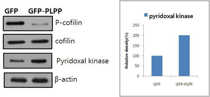 Western blot analysis of pyridoxal kinase and phospho-cofilin change in Hela cells.