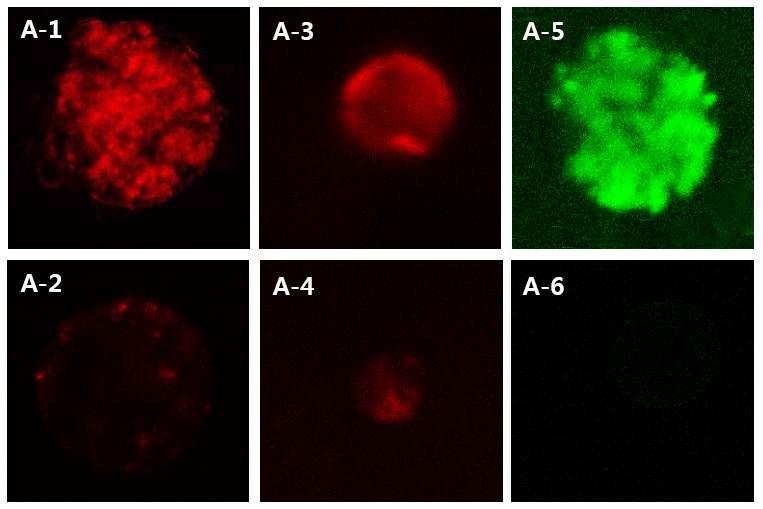 다공성 마이크로입자에 Ex4 및 Ex4-C16가 adsorption된 confocal laser scanning microscopy (CLSM) 사진