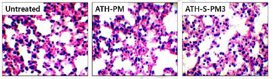 ex vivo 폐의 H&E 염색을 통한 독성 확인