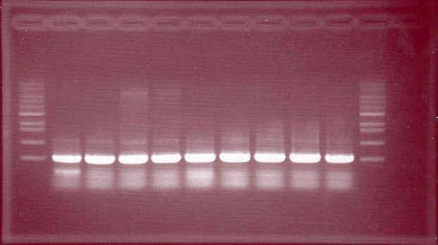 PCR