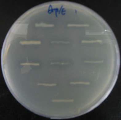 Detection of a esterase activity using tributyrin diffusion agar method