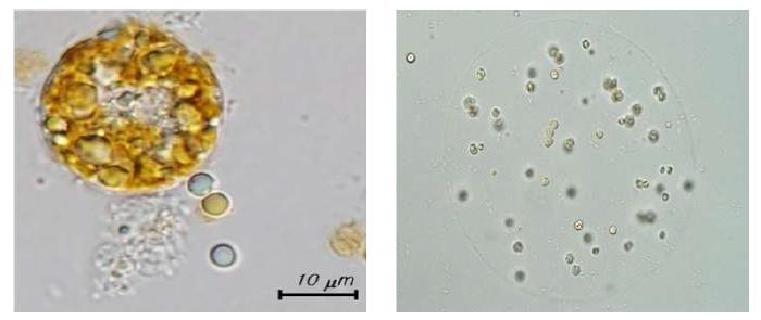 좌)Porosira glacialis 우)Phaeocystis antarctica 