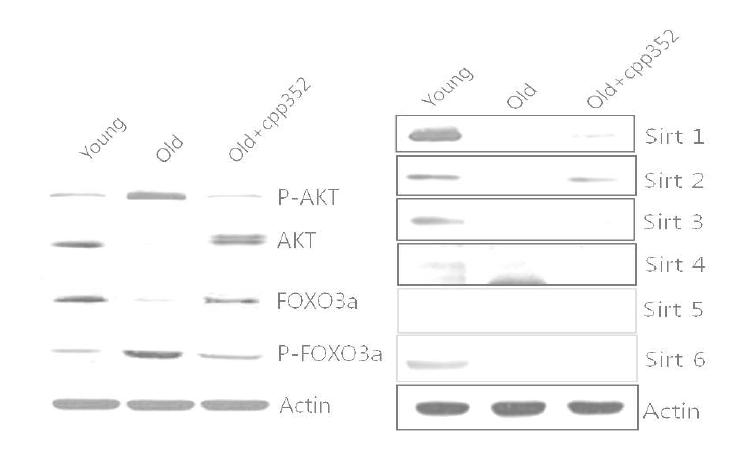 SIRT 활성화 물질에 의해 증가된 FOXO와 AKT의 관계 및 SIRT isoform 발현 비교