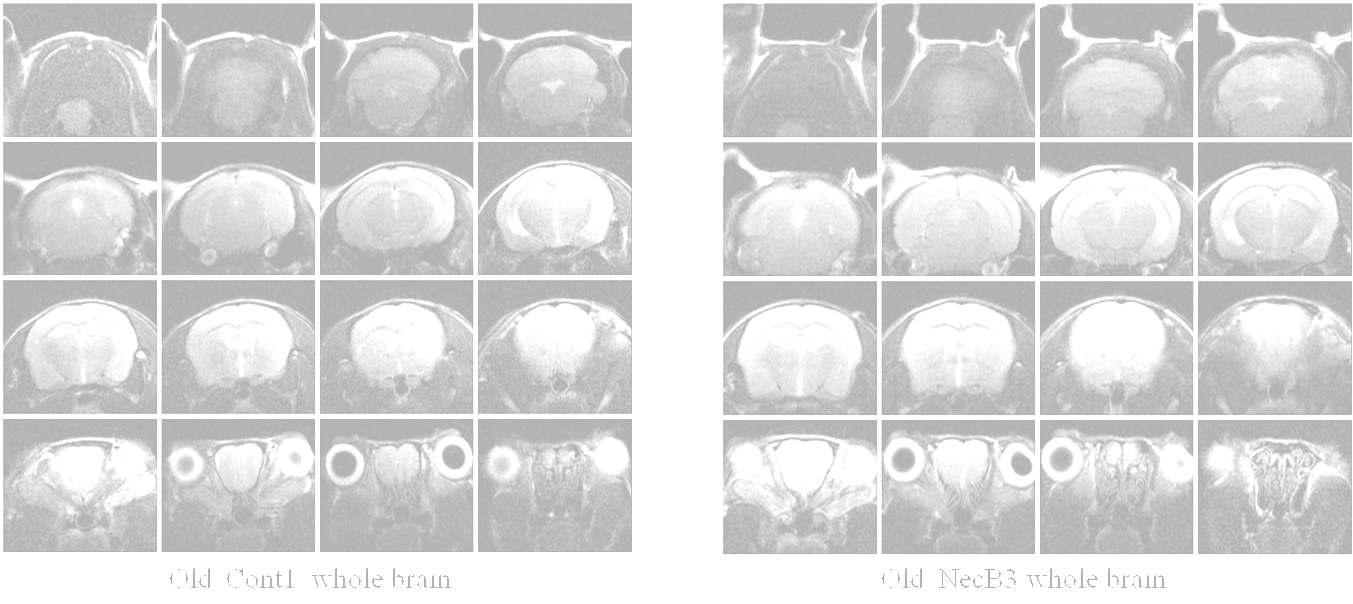 AMPK 활성화 물질을 처리 후 노화마우스의 whole brain 영상