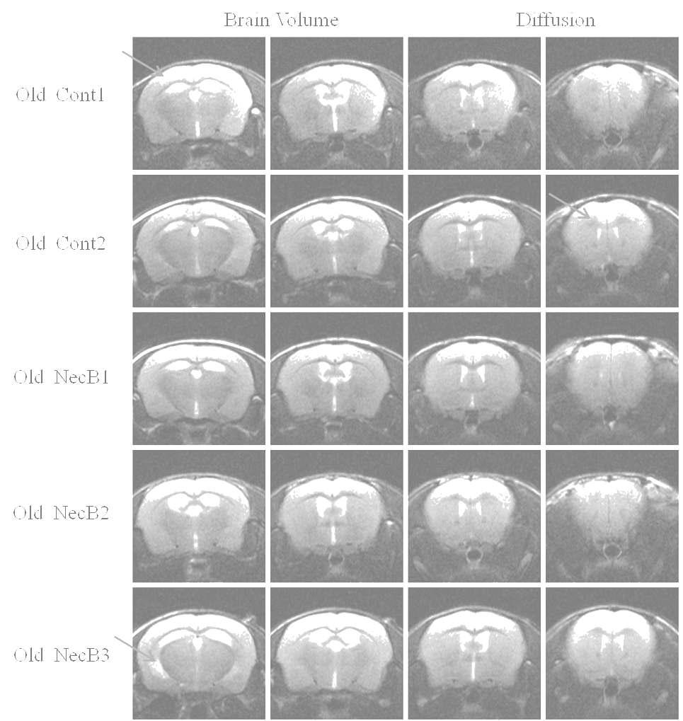 AMPK 활성화 물질을 처리 후 노화마우스의 brain volume 변화 및 확산영상