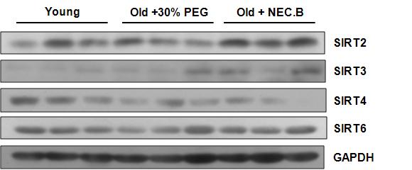 노화 동물에 AMPK 활성화 물질을 처리 후 근육에서 SIRT isoform 발현변화 확인