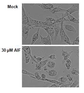 30μM의 AIF를 12시간동안 처리한 세포와 그렇지 않은 세포를 비교해 보았을 때, 처리한 세포의 대부분에서 수포화 현상이 나타남
