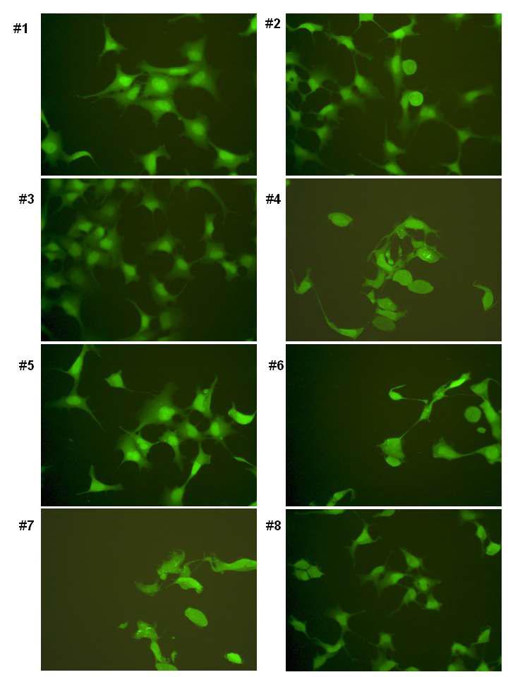 GFP-LC3 세포주에 식물에서 추출한 물질을 처리 후에 형광 현미경으로 관찰한 그림.