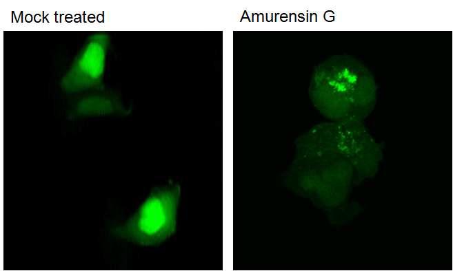 GFP-LC3 세포주에 amurensin G를 처리한 사진.