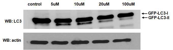 GFP-LC3 세포주에 amurensin G를 처리한 후에 GFP-LC3 단백질을 확인한 결과