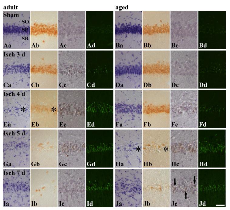 CV staining (a), NeuN immunohistochemistry (b), TUNEL staining (c) and F-J B histofluorescence staining (d) in the adult (left 4 columns) and aged (right 4 columns) CA1 in the sham- (A and B) and ischemia-operated (C-J) groups. Only a few CV+ cells and NeuN+ neurons are detected in the stratum pyramidale (SP, asterisk) 4days after I/R in the adult gerbil. However, in the aged group, the same degree of delayed neuronal death (asterisk) is observed 5 days after I/R. Many TUNEL+ cells and F-J B+ cells are detected in the SP 4 days after I/R in the adult gerbil. However, in the aged group, many TUNEL+ cells and F-J B+ cells are observed 5 days after I/R. In addition, TUNEL+ cells are still observed 7 days after I/R (arrows). SO, stratum oriens; SR, stratum radiatum. Scale bar = 50 μm.