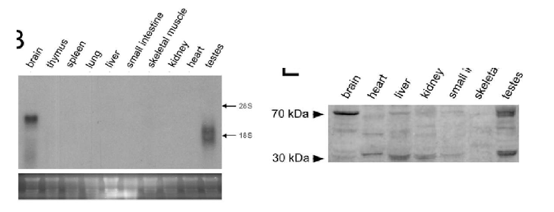 Northern blot analysis results for PRDM8. and Western blot analysis to observe PRDM8 expression.