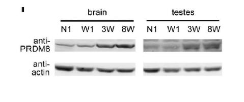 The expression of PRDM8 in brain and testis abruptly increased 3 week after birth.