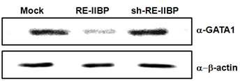 RE-IIBP represses translation of GATA1.