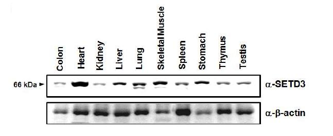 JMJD1B expression pattern in multiple tissues.