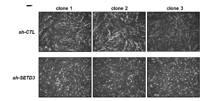 Phase-contrast images were taken 3 days after transfection of sh-SETD3 into H9c2 cells.