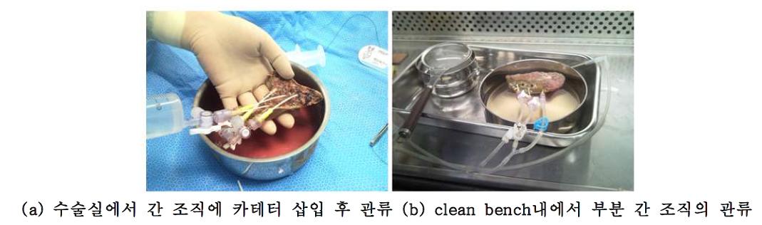 Hepatocytes isolation from human partial liver