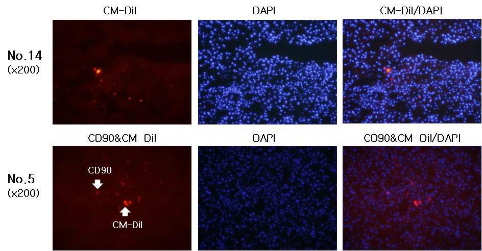 CM-Dil을 부착한 간 줄기세포를 이식 후 적출한 간조직의 면역형광염색결과
