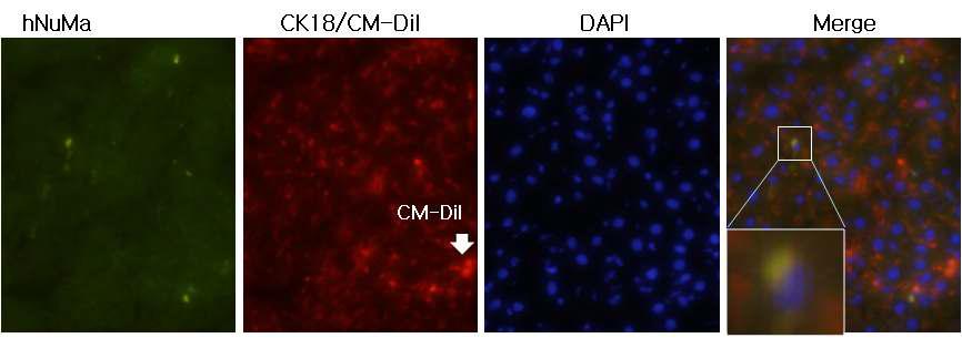 CM-Dil을 부착한 간 줄기세포를 이식 후 적출한 간조직의 면역형광염색결과