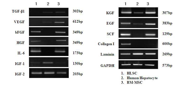 세포에서 발현하는 사이토카인, 성장인자, 세포외기질(Extracellular matrix) RT-PCR 분석