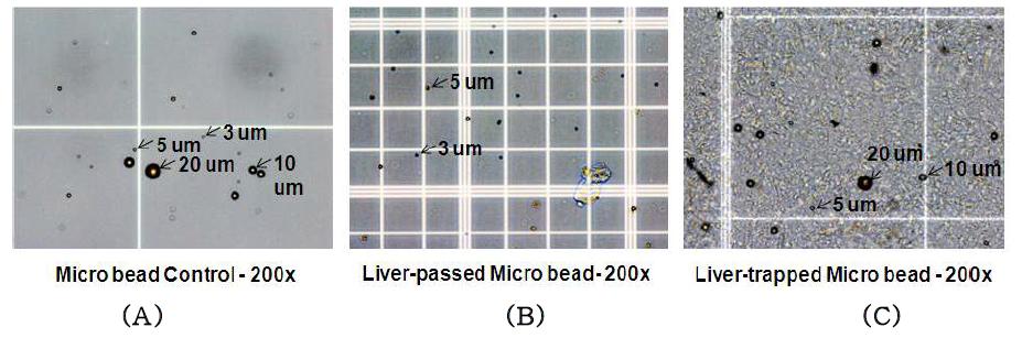 쥐 간을 통과한 M icrobead (3, 5, 10, 20 ㎛) 현미경사진