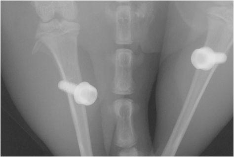 Micro CT image of rat tibias placed with titanium implants.