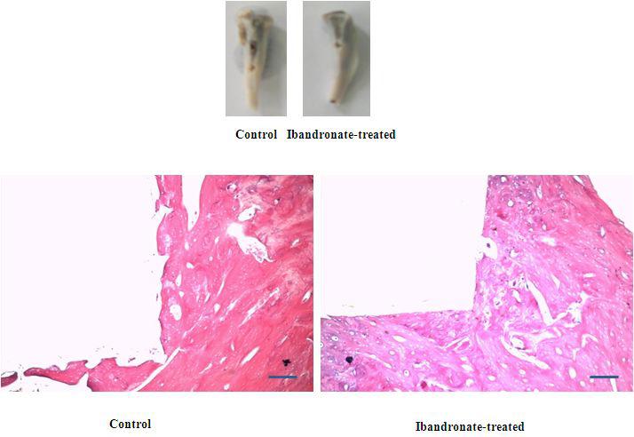 Osteointegration of ibandronate coated alloy