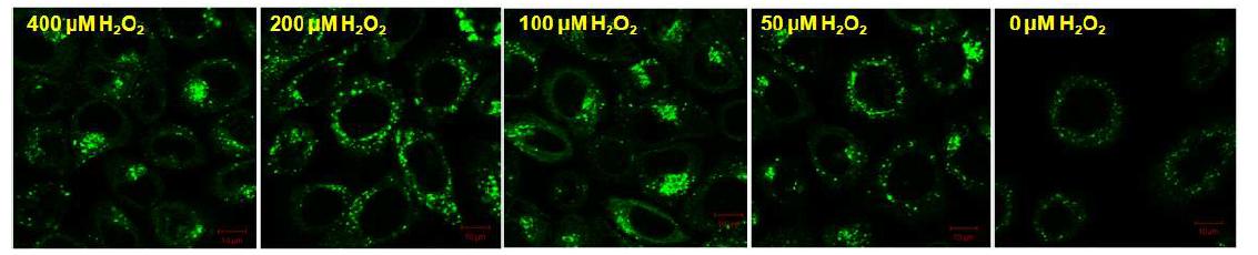 HeLa cell에 H2O2를 처리한 후 리소좀의 활성도 분석