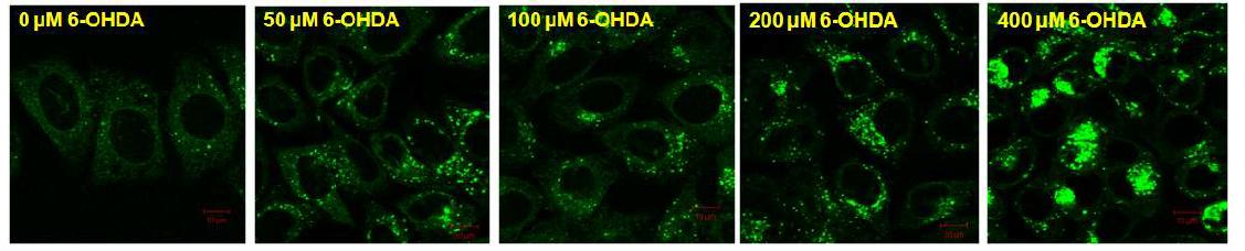 HeLa cell에 6-OHDA를 처리한 후 리소좀의 활성도 분석