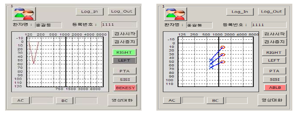 Bekesy 청력검사(좌) 및 ABLB 청력검사(우)를 진행 중인 화면.