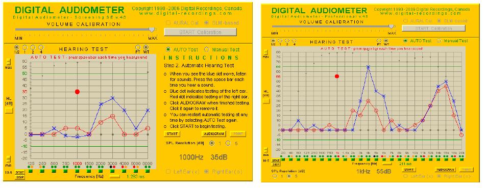 디지털 청력검사기의 검사 화면.