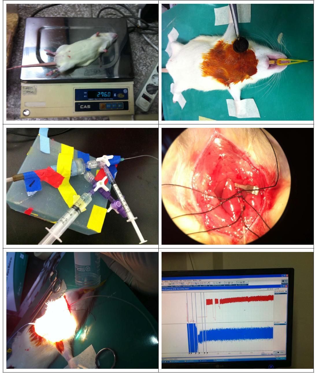 Direct blood pressure measurement