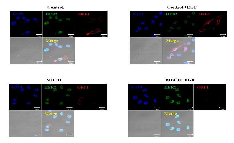 GM-1과 HER2의 localization 관찰
