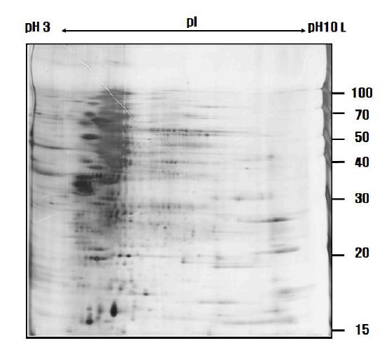 60㎍의 protein, rehydration bufferⅠ, pH 3-10 leaner IPG gel strip (18 cm), single strip holder를 이용한 R. sphaeroides의 proteome map