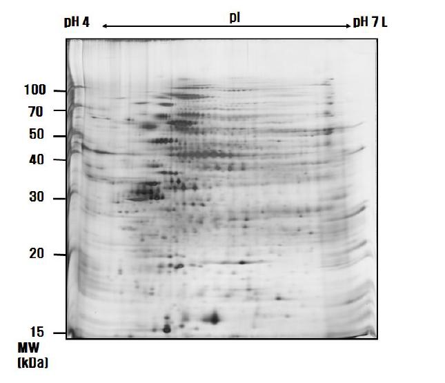 60㎍의 protein, rehydration bufferⅠ, pH 4-7 leaner IPG gel strip (18 cm), single strip holder를 이용한R. sphaeroides의 proteome map