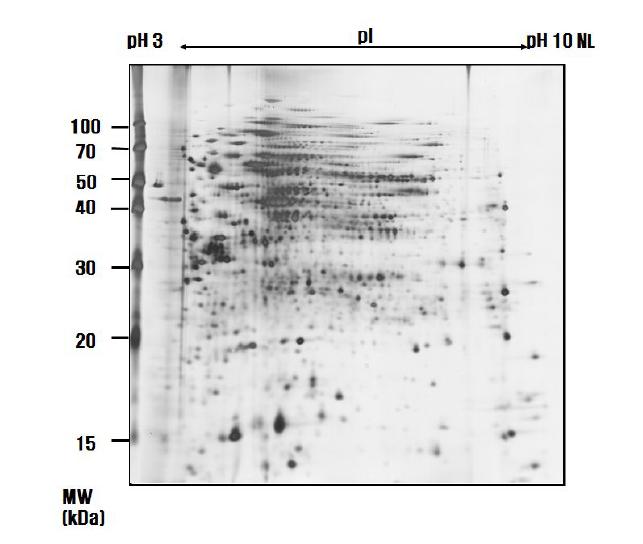 60㎍의 protein, rehydration bufferⅠ, pH 3-10 non-leaner IPG gel strip (18cm), cup loading을 이용한 R. sphaeroides의 proteome map